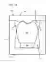 Fig. 14 - Dental prosthesis manufacturing aids