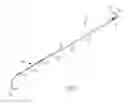 Fig. 02 - VAGINAL BAND SYSTEM