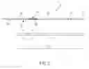Fig. 03 - VAGINAL BAND SYSTEM