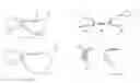 Fig. 06 - Horizontal osteotomy implant, and methods of using the same