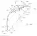 Fig. 22 - Horizontal osteotomy implant, and methods of using the same