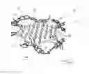 Fig. 03 - Surgical implant