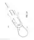 Fig. 33 - System and method for securing tissue to bone