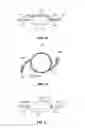 Fig. 02 - Intraocular lens and methods for accommodating existing adaptive intraocular lenses