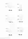Fig. 05 - Intraocular lens and methods for accommodating existing adaptive intraocular lenses