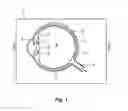 Fig. 02 - Modular intraocular lens designs, tools and methods