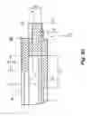 Fig. 08 - Modular intraocular lens designs, tools and methods
