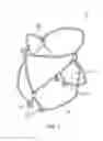 Fig. 02 - Prosthetic heart valve