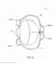 Fig. 03 - Prosthetic heart valve