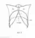 Fig. 04 - Prosthetic heart valve