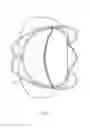 Fig. 06 - Prosthetic heart valve