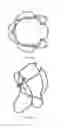 Fig. 08 - Prosthetic heart valve