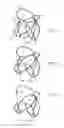 Fig. 09 - Prosthetic heart valve