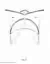 Fig. 12 - Prosthetic heart valve