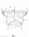 Fig. 02 - Transcatheter valve prosthesis