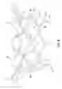 Fig. 07 - Transcatheter valve prosthesis