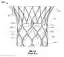 Fig. 02 - Commissure attachment features for improved delivery flexibility and tracking