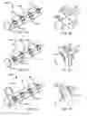 Fig. 07 - Methods, devices, and systems for percutaneously anchoring annuloplasty rings