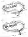 Fig. 09 - Methods, devices, and systems for percutaneously anchoring annuloplasty rings