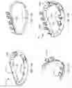 Fig. 15 - Methods, devices, and systems for percutaneously anchoring annuloplasty rings