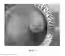 Fig. 06 - Compression resistant implants including an oxysterol and methods of use
