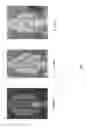 Fig. 08 - Compression resistant implants including an oxysterol and methods of use