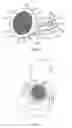 Fig. 03 - Implants with frangible fastener port plugs and methods of manufacturing implants with frangible fastener port plugs