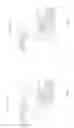 Fig. 08 - POSTERIORLY STABILIZED TOTAL KNEE JOINT PROSTHESIS