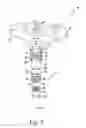 Fig. 03 - Releasable threaded connection for modular implants