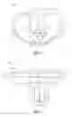 Fig. 02 - Method for optimizing implant designs