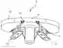 Fig. 01 - Arthroplasty systems and methods