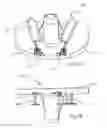 Fig. 06 - Arthroplasty systems and methods