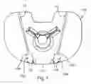 Fig. 08 - Arthroplasty systems and methods