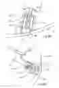 Fig. 09 - Arthroplasty systems and methods
