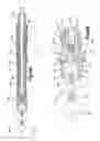Fig. 15 - INTERVERTEBRAL IMPLANT INSERTER AND RELATED METHODS