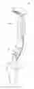 Fig. 01 - Surgical shoulder articulation replacement method