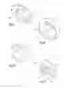 Fig. 07 - Surgical shoulder articulation replacement method
