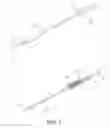 Fig. 02 - APPARATUS AND METHOD FOR LOADING AND DELIVERING A STENT USING A SUTURE RETAINING MECHANISM