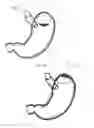 Fig. 08 - Systems and methods for magnetically positioning a gastric device