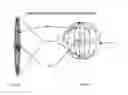 Fig. 24 - Systems and methods for magnetically positioning a gastric device