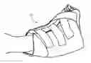 Fig. 01 - Heel protector and corresponding rehabilitation systems and methods for using the same