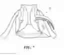 Fig. 06 - Heel protector and corresponding rehabilitation systems and methods for using the same