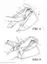 Fig. 07 - Heel protector and corresponding rehabilitation systems and methods for using the same