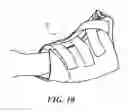 Fig. 08 - Heel protector and corresponding rehabilitation systems and methods for using the same