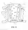 Fig. 09 - Heel protector and corresponding rehabilitation systems and methods for using the same