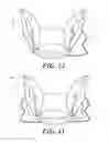 Fig. 10 - Heel protector and corresponding rehabilitation systems and methods for using the same