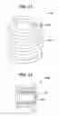 Fig. 07 - Tympanic membrane pressure equalization tube