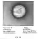 Fig. 45 - LIPOSOMAL NANOCONSTRUCTS AND METHODS OF MAKING AND USING THE SAME