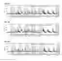 Fig. 08 - COMPOUNDS AND METHODS FOR THE TREATMENT OF NEUROLOGICAL DISORDERS