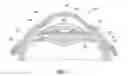 Fig. 02 - Prostamide-containing intraocular implant